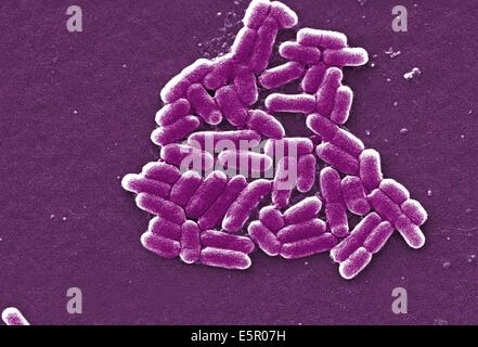 L'analyse des électrons Microphotographie (SEM) de la bactérie Escherichia coli, grossissement 6836x. Banque D'Images
