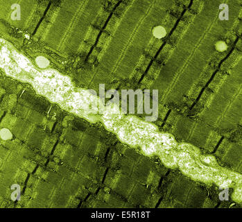 Micrographie électronique à transmission (TEM) d'une fine coupe longitudinale à travers une zone de tissu musculaire squelettique humain. Banque D'Images