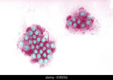 Micrographe des virus de Norwalk, un virus à ARN de la famille des Caliciviridae (Norovirus) responsable de la gastroentérite. Banque D'Images