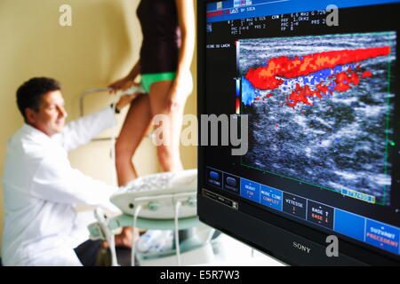 Un patient en cours d'échographie Doppler (angiodynography) scan des jambes. Banque D'Images