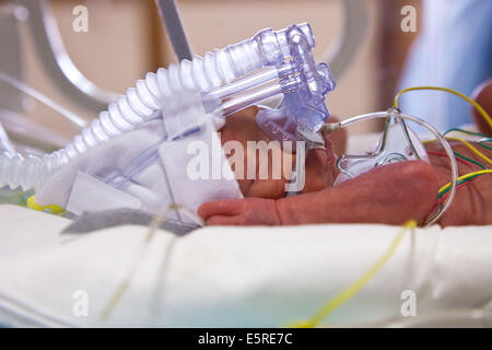 Bébé nouveau-né prématuré placé sous assistance respiratoire, département de néonatalogie, hôpital Robert Debré, Paris, France. Banque D'Images