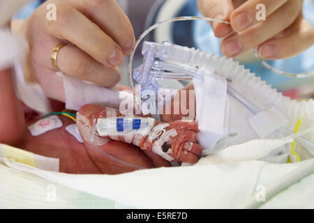 Bébé nouveau-né prématuré placé sous assistance respiratoire, département de néonatalogie, hôpital Robert Debré, Paris, France. Banque D'Images