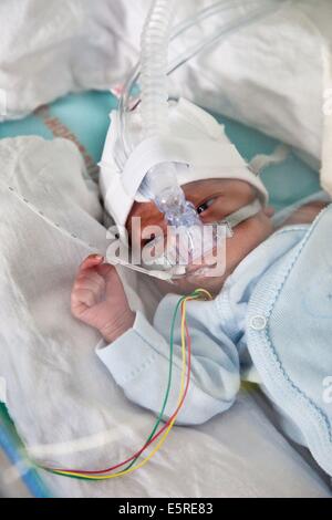 Bébé nouveau-né prématuré placé sous assistance respiratoire, département de néonatalogie, hôpital Robert Debré, Paris, France. Banque D'Images