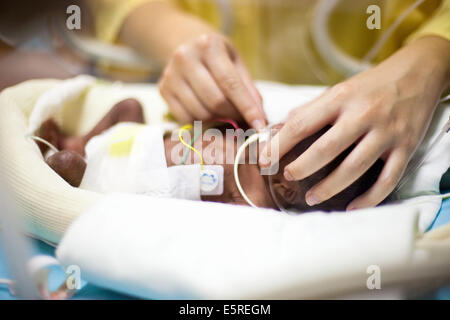 Bébé nouveau-né prématuré placé sous assistance respiratoire, département de néonatalogie, hôpital Robert Debré, Paris, France. Banque D'Images