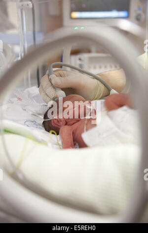 Bébé nouveau-né prématuré placé sous assistance respiratoire, département de néonatalogie, hôpital Robert Debré, Paris, France. Banque D'Images