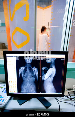 EOS biplanar scanner à rayons X, cette 2D et 3D digital X-ray imaging équipement est dédié à la pratique orthopédique et permis Banque D'Images
