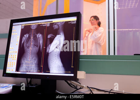 EOS biplanar scanner à rayons X, cette 2D et 3D digital X-ray imaging équipement est dédié à la pratique orthopédique et permis Banque D'Images