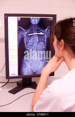 EOS biplanar scanner à rayons X, cette 2D et 3D digital X-ray imaging équipement est dédié à la pratique orthopédique et permis Banque D'Images