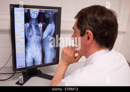 EOS biplanar scanner à rayons X, cette 2D et 3D digital X-ray imaging équipement est dédié à la pratique orthopédique et permis Banque D'Images
