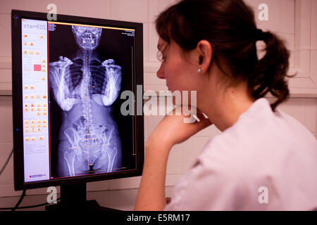 EOS biplanar scanner à rayons X, cette 2D et 3D digital X-ray imaging équipement est dédié à la pratique orthopédique et permis Banque D'Images