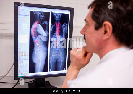 EOS biplanar scanner à rayons X, cette 2D et 3D digital X-ray imaging équipement est dédié à la pratique orthopédique et permis Banque D'Images