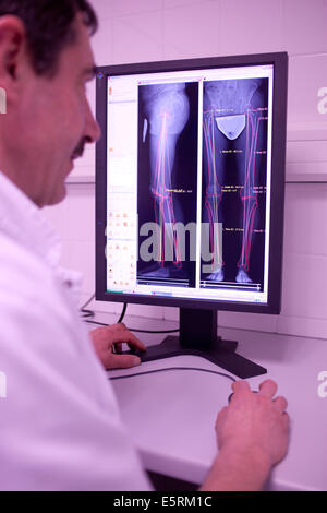 EOS biplanar scanner à rayons X, cette 2D et 3D digital X-ray imaging équipement est dédié à la pratique orthopédique et permis Banque D'Images