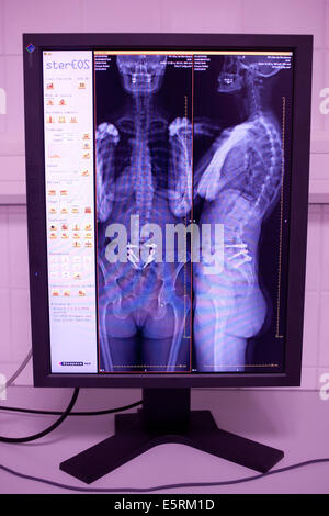 EOS biplanar scanner à rayons X, cette 2D et 3D digital X-ray imaging équipement est dédié à la pratique orthopédique et permis Banque D'Images