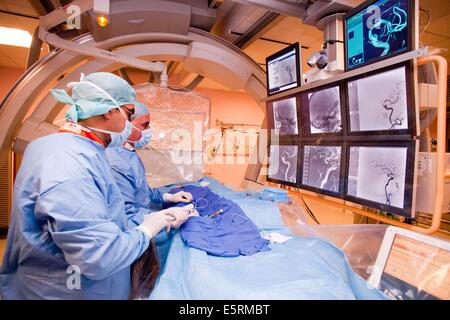 Traitement de la sténose carotidienne par angioplastie et stent réglage prothèse, ici, d'un cathéter inséré dans une veine sous Banque D'Images