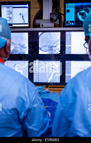 Traitement de la sténose carotidienne par angioplastie et stent réglage prothèse, ici, d'un cathéter inséré dans une veine sous Banque D'Images