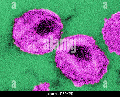 Détails de deux virus de l'immunodéficience humaine (VIH) particules de virus, ou des virus, micrographie électronique à transmission (TEM). Banque D'Images