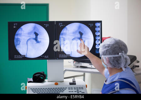 Un ureterorenoscopy laser flexible, lithotripsie, un ureterorenoscope est introduit par l'urètre de pulvériser Banque D'Images