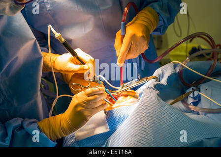 Traitement du ronflement l'amygdalectomie (ablation des amygdales), hôpital Foch, Suresnes, France. Banque D'Images