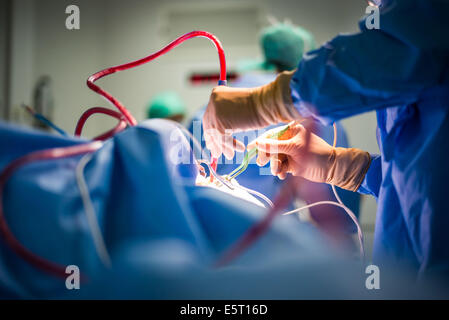 Traitement du ronflement l'amygdalectomie (ablation des amygdales), hôpital Foch, Suresnes, France. Banque D'Images