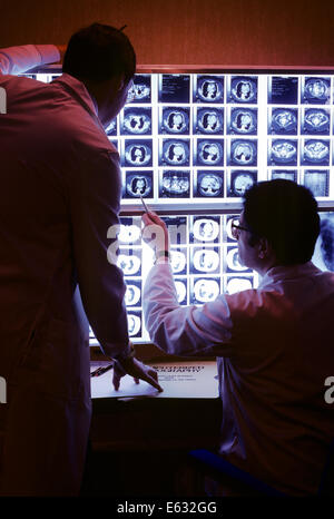 Des années 1980, deux médecins examinant un TOMODENSITOGRAMME DE LA POITRINE FILMS Banque D'Images