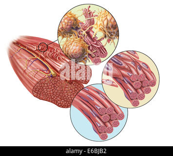 Les fibres musculaires déchirés avec étapes entourant la guérison. 1. Nettoyage des macrophages. 2. De nouvelles cellules migrent pour réparation. 3. Différence des cellules Banque D'Images