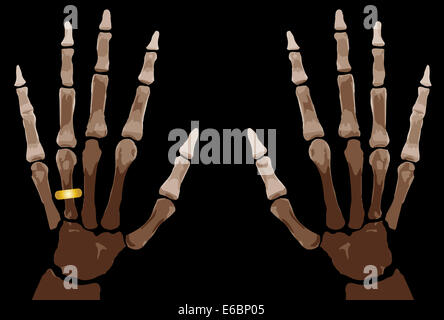 Les os de la main isolé sur fond blanc Banque D'Images
