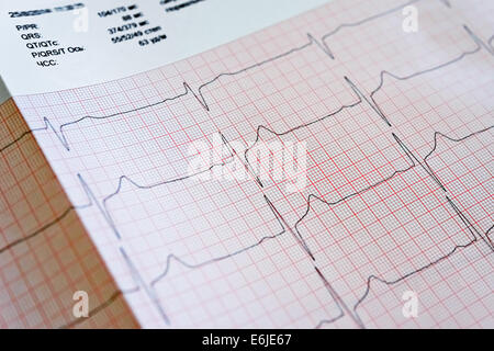 Électrocardiogramme Banque D'Images