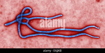 Vue microscopique du virus Ebola. Ce micrographe colorisée vue sur la morphologie ultrastructurale affichées par un virion du virus Ebola a été capturé par la CDC. Banque D'Images