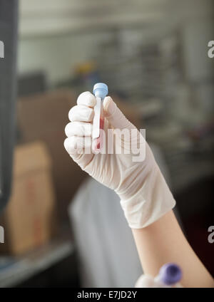 Technician holding échantillon de sang au laboratoire Banque D'Images