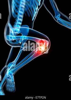 Les droits de l'anatomie d'une flexion du genou, de l'oeuvre de l'ordinateur. Banque D'Images