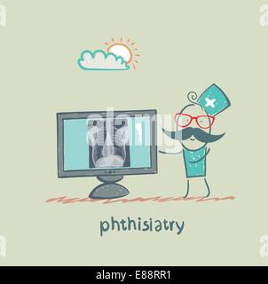 Phthisiatry La radiographie montre Illustration de Vecteur