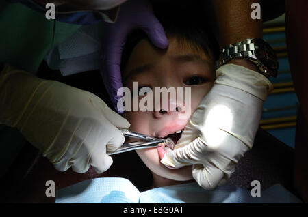 Pince d'extraction de dent dentiste tenant des enfants asiatiques, Close up Banque D'Images