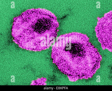 Cette fine-section micrographie électronique à transmission (TEM) décrit les détails ultrastructuraux de nombre de "droits de l'immunodéficience humaine Banque D'Images