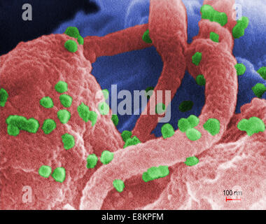 Cette micrographie électronique à balayage a révélé la présence de virus de l'immunodéficience humaine (VIH-1), (sphérique en apparence), qui Banque D'Images