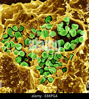 Micrographie électronique à balayage des macrophages murins infectés par Francisella tularensis LVS souche ont été macrophages Banque D'Images