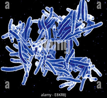 Micrographie électronique à balayage de la bactérie Mycobacterium tuberculosis, qui cause la tuberculose. Banque D'Images