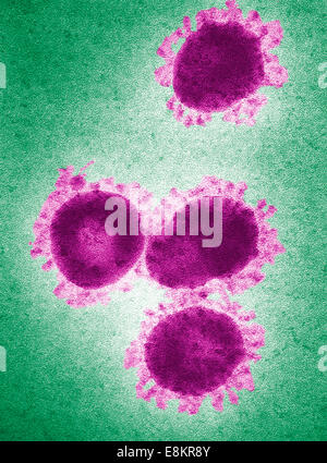 Cette colorisée numériquement micrographie électronique à transmission (MET) a révélé la présence de nombre de virus de la bronchite infectieuse Banque D'Images