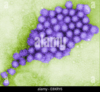 Cette micrographie électronique à transmission (MET) a révélé une partie de la morphologie ultrastructurale affichée par les norovirus, virions ou Banque D'Images