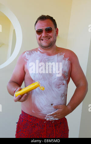 Très soleil brûlé man applying cream Banque D'Images