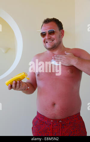 Très soleil brûlé man applying cream Banque D'Images