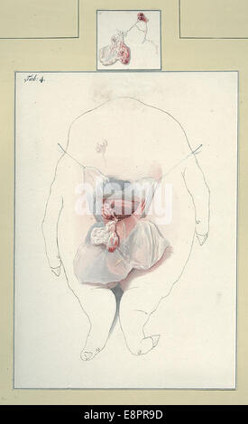 Date : ca. 1820-1840 Image Description : un foetus de porc sans tête avec des organes exposés. Coincés string tient ouverte la peau. Un petit Banque D'Images