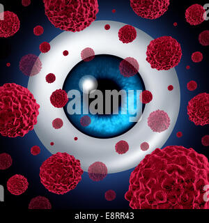 L'oeil concept ou cancers intraoculaire comme un symbole de l'œil avec les cellules cancéreuses en santé et de soins médicaux Banque D'Images