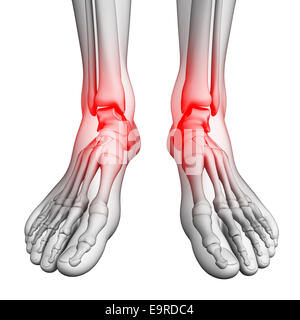 Illustration de la douleur de pied artwork Banque D'Images