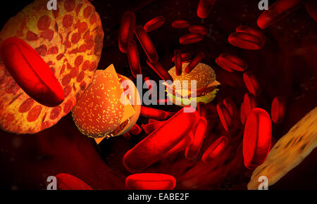 Cholestérol artère bloquée, concept médical Banque D'Images