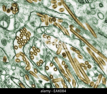 Micrographe colorisée de l'influenza aviaire A H5N1. Les fournisseurs de contenu : CDC/ Gracieuseté de Cynthia Goldsm Banque D'Images