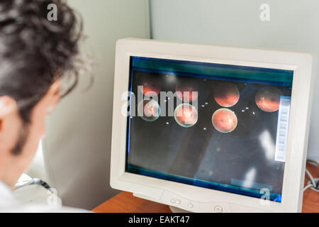 Un jeune ophtalmologiste à à un scan de la rétine dans l'écran d'un ordinateur Banque D'Images