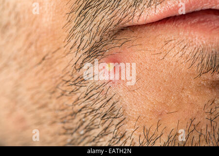 Caucasian man with stub et gros bourgeon Banque D'Images