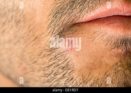 Caucasian man with stub et gros bourgeon Banque D'Images