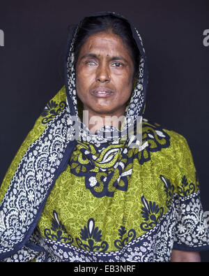 De veille, au Bangladesh. Mar 9, 2014. Mode Tazreen Shahnaz survivant Begum âge de 36 ans est passé de 3e étage de l'immeuble vivant avec eye et problème de backbone.Ils n'ont jamais su l'obscurité de la sinistre nuit pourrait être le prélude d'un autre sombre épisode de leur vie en attente de l'avant.La nuit lourde d'air avec de la fumée et de la chaleur, et le bruit des cris de terreur, les nombreuses personnes piégées à l'intérieur de l'édifice ultra Tazreen Fashions -- n'étaient que le début d'une longue lutte.Le 24 novembre 2012, plus de 120 personnes brûlées à mort après avoir été coincé derrière des sort à l'Tazreen Fashion Banque D'Images