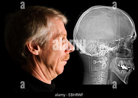 L'homme à côté de son scanner (scanner de la tête. Banque D'Images